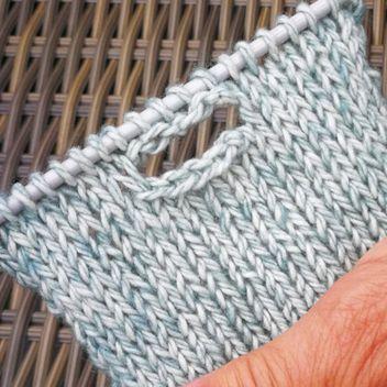 X-Napinläven neulominen